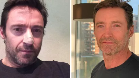 Austrálsky herec Hugh Jackman po prvej biopsii v roku 2013.