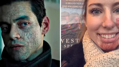 Rami Malek v najnovšom filme o Jamesovi Bondovi. / Catrin Pughová, ktorá žije s rozsiahlymi popáleninami.