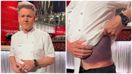 Gordon Ramsay sa vážne zranil na bicykli. Ak by nemal prilbu, už zrejme nie je medzi živými.