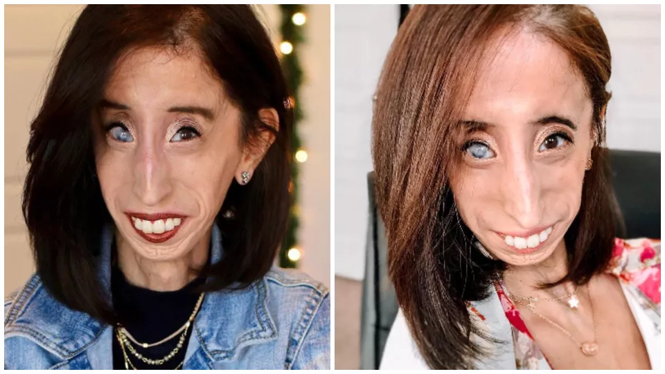 Lizzie Velásquezová